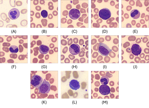 Figure 1: Example images of the 13 white blood cell classes